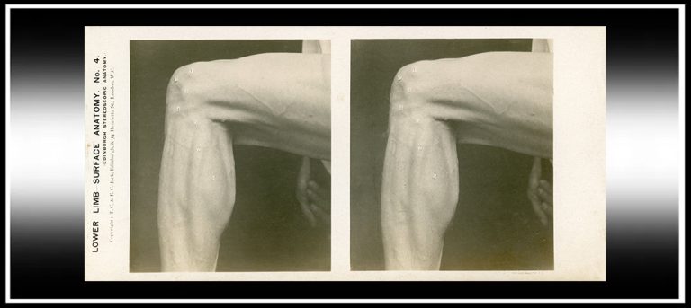 Medical Training and Visualisation – The Stereoscopy Blog